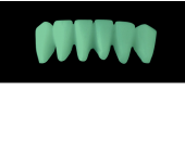 Cod.C9Facing : 10x  wax facings-bridges,  LARGE, Aligned, TOOTH 43-33, compatible with Cod.A9Lingual,TOOTH 43-33 for long-term provisionals preparation